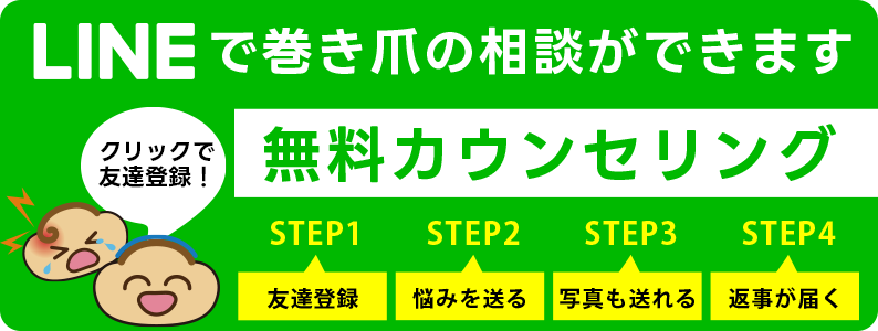 墨田区巻き爪センターへLINEで無料相談